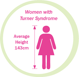 syndrome turner height average features nz characteristics clinical ts physical emaze ireland